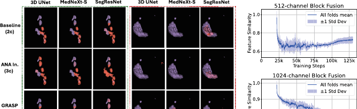 GRASP qualitative results on PET/CT: baseline predictions (left) vs. GRASP-enhanced predictions (right), showing improved alignment of tumor delineation with anatomical boundaries.