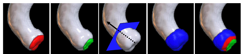 TAVR-relevant anatomical structures extracted from CT: aorta (grey), valve (red), annulus (green), and aortic root (blue).